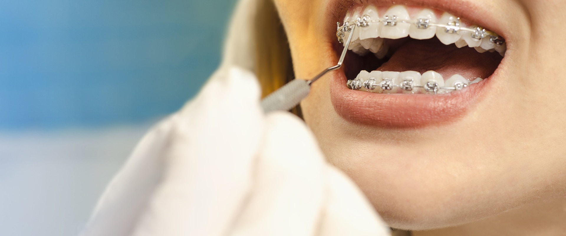 Can Adults Get Orthodontic Treatment?