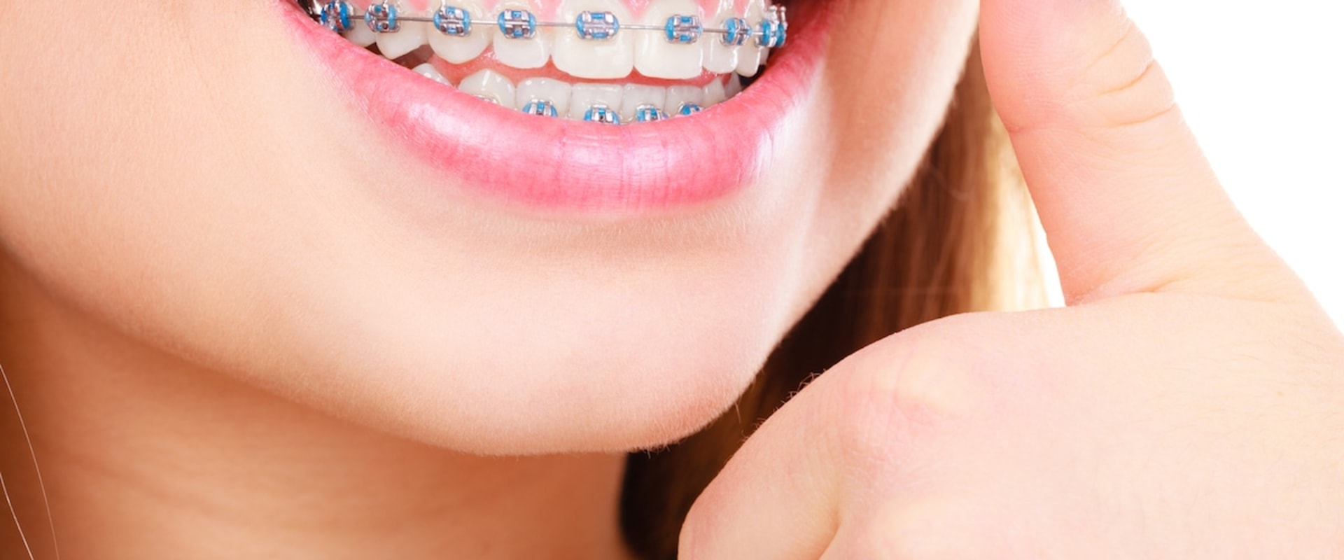 The Benefits of Orthodontics and How to Choose the Right Orthodontic