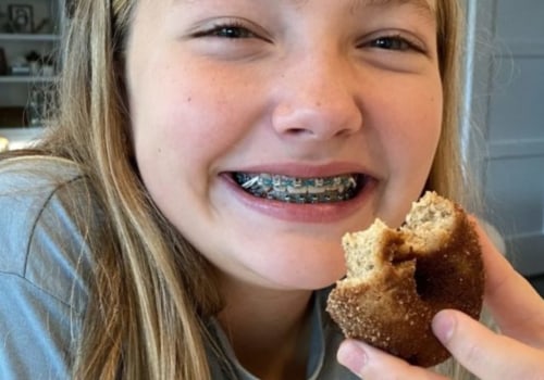 What to Eat in the First 3 Days of Braces