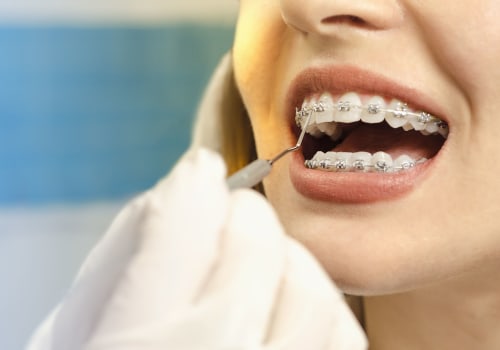 Can Adults Get Orthodontic Treatment?