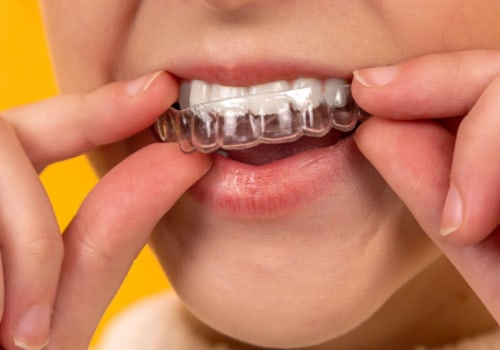 Invisalign vs Braces: Which is Easier to Talk With?