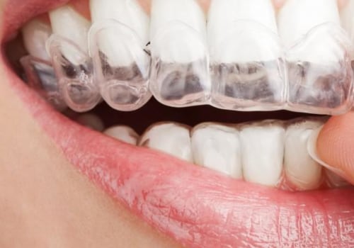 Sleeping with Braces or Aligners: What You Need to Know