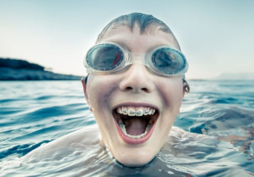 Swimming with Braces or Aligners: What You Need to Know