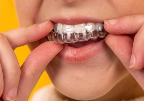 Can I Get Invisalign with Missing Teeth or Gaps in My Teeth?