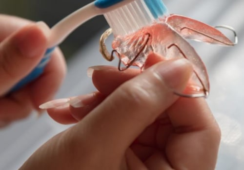 How to Clean Your Retainer and Keep it in Good Shape