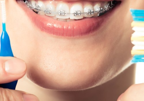 Using a Phone with Braces or Aligners: Expert Tips